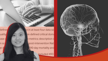 Collage featuring photos of Dr. Jialin Mao, a person typing on a laptop, and an x-ray of the brain